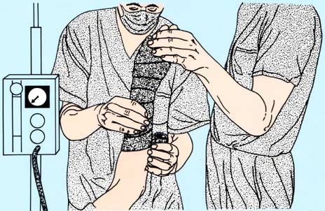 medical graphic illustration
