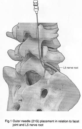 Medical illustration